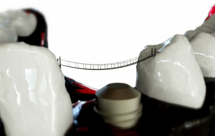 Naturheilkunde in der Zahnmedizin – Worauf sollte man achten? Naturheilkunde in der Zahnmedizin – Worauf sollte man achten?