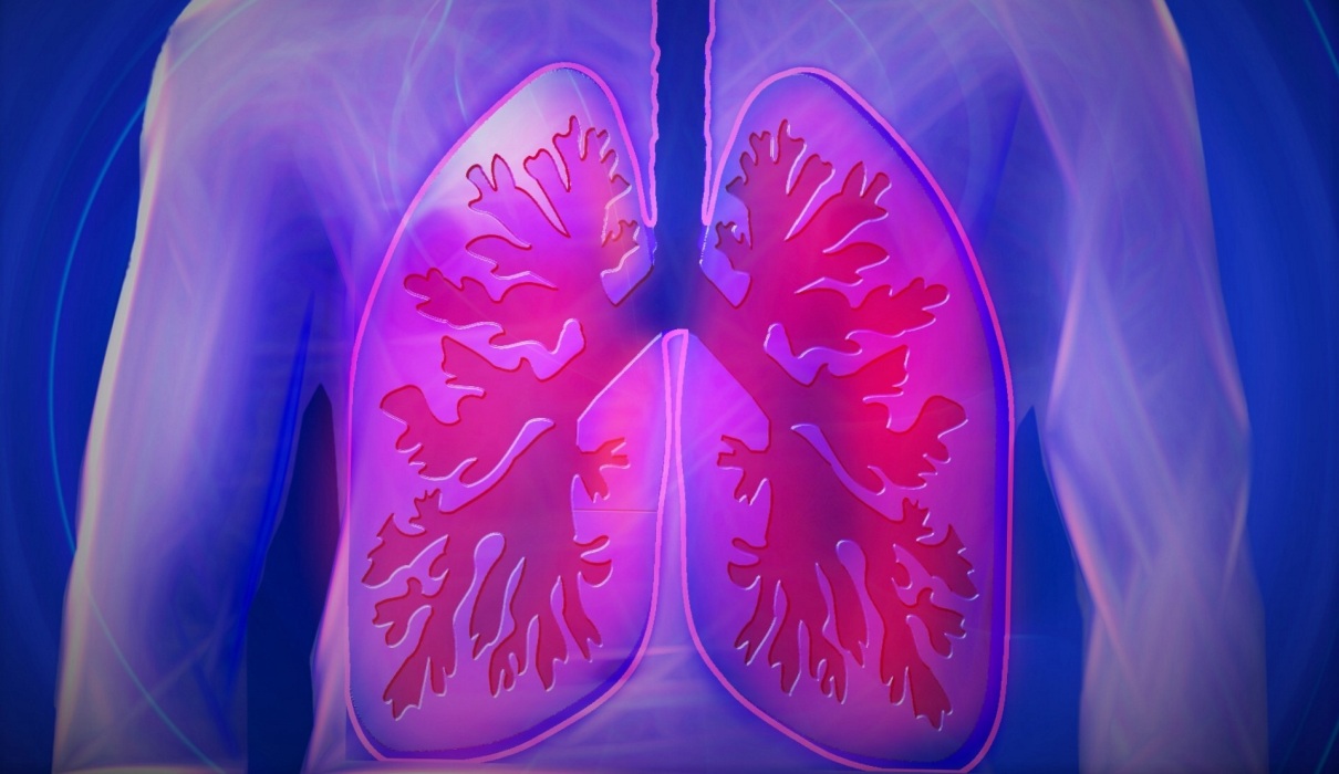 Lungenkrankheiten - wenn unser Atemorgan leidet